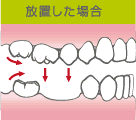 放置した場合